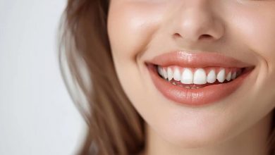 diş beyazlatma, diş beyazlatma fiyatları, gülüş tasarımı (1)